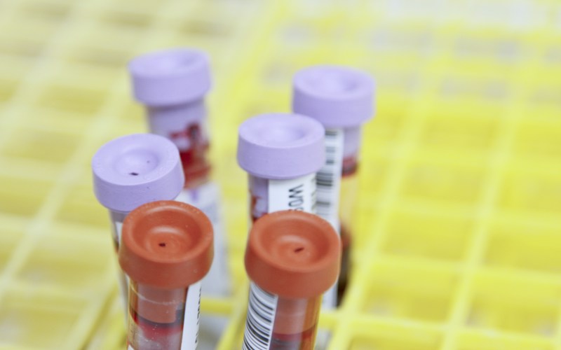 Verifying Reagent Lot Changes in Clinical Laboratories
