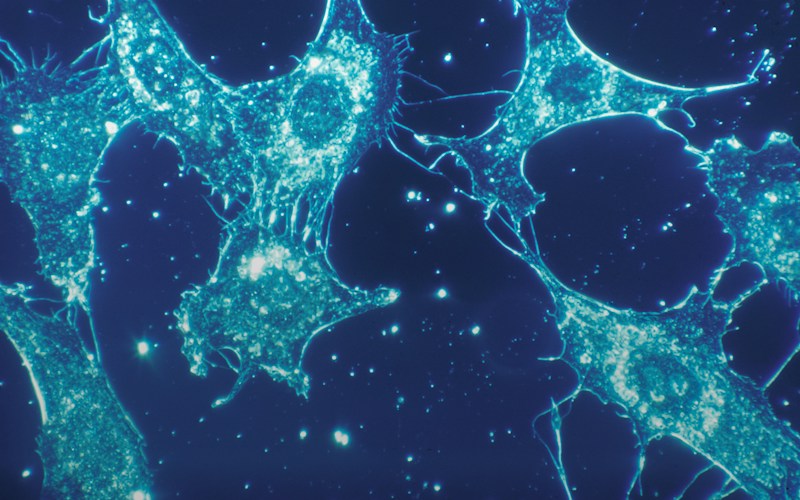 Microscopic view of normal human connective-tissue cells growing in culture.